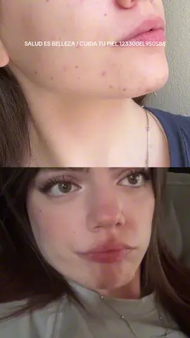 El mejor hábito para tener un glow up es cuidarse a uno mismo.  @La Roche-Posay #albaclouthier #effaclar #publicidad 