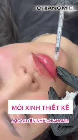 TIÊM MÔI XINH ✨ 👉🏻 Thiết kế môi theo từng khuôn mặt, độc quyền ít đụng hàng, dựa trên shape môi cũ của bạn .  👉🏻 Nhận chỉnh sửa lại môi lỗi, tiêm sai lệch ko đẹp ở cơ sở khác .  𝐍𝐇Ữ𝐍𝐆 𝐓𝐑ƯỜ𝐍𝐆 𝐇Ợ𝐏 𝐍Ê𝐍 𝐓𝐈Ê𝐌 𝐌Ô𝐈 : *  Môi không cân xứng. *  Môi nhiều nếp nhăn. *  Người có môi mỏng, không rõ shape. *  Hoặc mong muốn thay đổi sang các dáng môi trendy #tiemmoi #tiemmoifiller #tiemmoitay #tiemmoibaby  @VIỆN THẨM MỸ CHIANG MIE @HỌC VIỆN CHIANG MIE  ——————————————— #CapCut 