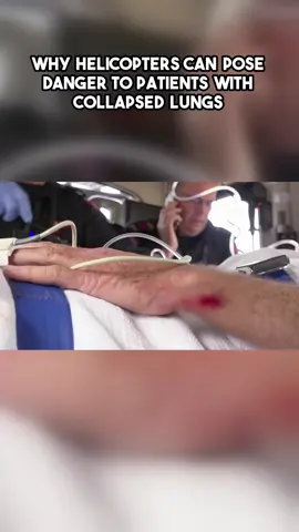 In the heart-racing world of emergency response, every second counts, and the stakes couldn’t be higher. The complexities of medical interventions take center stage as paramedics navigate challenges that can make or break a life. Witness the intense decision-making process when trapped air poses a risk to a patient's already compromised lung during a helicopter lift-off. The team grapples with the consequences of altitude and its potential to worsen critical conditions, all while ensuring the best moves for their patients. A twisting tale unfolds when a woman is injured by her horse, leading paramedics to gauge her alarming blood pressure and memory issues. From assessing head trauma after a 500kg horse throw to the intricacies of cardiac emergencies complicated by Parkinson's, this gripping video showcases raw moments that highlight the all-too-real challenges faced by emergency medical professionals. Don't miss this inside look into the high-stakes decisions made in life-or-death scenarios. It’s a reminder that sometimes, what seems like the quickest route isn’t always the safest when lives are on the line. #EmergencyResponse #Paramedics #LifeSaving #MedicalEmergency #FirstResponders #TraumaCare #CriticalCare #HelicopterRescue #IntensiveCare #HealthCareHeroes #HorseAccident #FirstAid #AdrenalineRush