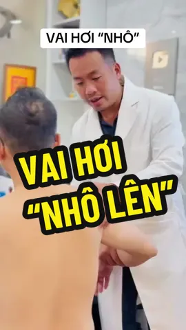 Vai hơi “nhô lên”- Tổn thương khớp cùng đòn là 1 nguyên nhân khiến nhiều người lo lắng. #tratkhopcungdon #daukhopvai #viemkhopvai #bsnguyenviettan #bacsicoxuongkhop @Bs Tân thích khám khớp Vai 