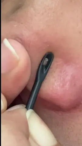 Say bye-bye to whiteheads, blackheads & dry skin with Jumiso! Pores rasa clean, kulit terus lembap & glowing ✨ 💚  Blackhead Melting Softener – helps clear out sebum & impurities. 🩵 Waterfull Hyaluronic Acid Toner – locks in hydration, kulit nampak fresh all day. Dua-dua memang best kalau nak kulit bersih + radiant & once you try, your skin will love it 🫶🏼 Grab yours now so you start your skincare journey with Jumiso! #jumiso #jumisopartner #jumisoblackheadmeltingsoftener #jumisowaterfullhyaluronicacidtoner #koreanskincare @Jumiso Malaysia @StyleKorean Malaysia 