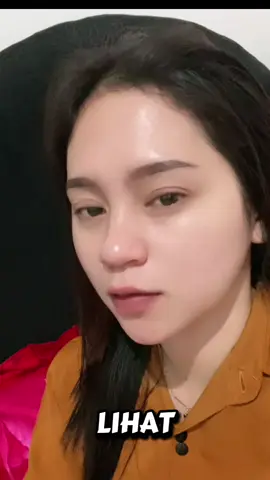 Cukup rutinin bekas jerawat akan pudar dan menghilang dengan sendirinya #rodeos #serum #penghilangbekasjerawat #foryoupageofficiall #keranjangkuning 