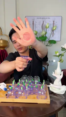 Bộ giác hơi 12 cốc giác giúp lưu thông khí huyết giảm đau mỏi cơ xương khớp, #bogiachoi12ong #xuhuong #chamsocsuckhoechudong #bogiachoikhongdunglua #bogiachoichankhong 