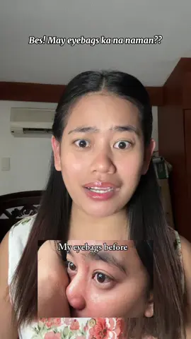 A vibrating eye cream for my eyebags #icelerskin #eyebag #eyecream 