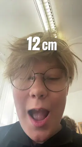 #fyp #fypシ 