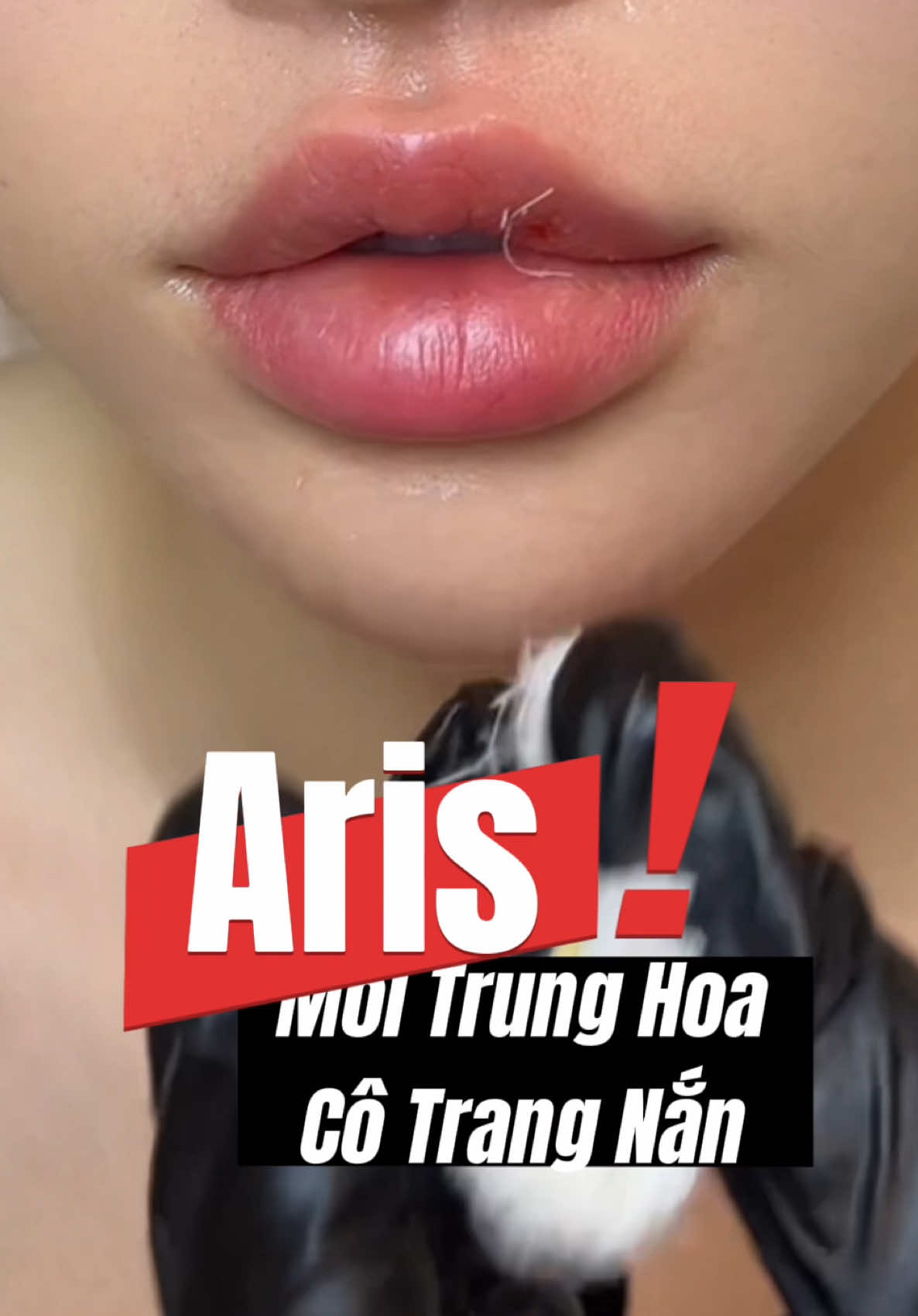 Môi Trung Hoa Cô Trang tiêm chỉ có đỉnh thôi . Đặt gần full lịch Tết rồi #xuhuong #arisaesthetictraininglab #TruyềnLửaNghề 