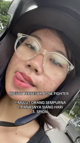 kira kira apa lagi yakk #acnefighter #acne #bekasjerawat 