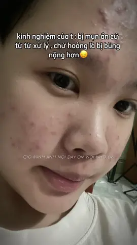 KHÔNG NHẬN BOOKING !