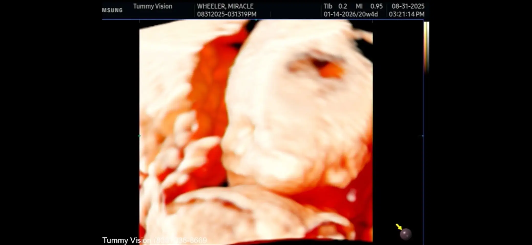 after four miscarriages in the last one being our twins, I almost let this precious moment, slip away had a fear of getting too close and losing this pregnancy too. God has a plan and he knows what he’s doing. I am choosing to trust him fully. He knows what we need when we need it. I have stepped out of faith and I’m believing that everything will be all right. I even named this one and actually bought a few baby things. Welcome my new baby boy coming to you soon in January 7, 2026. Messiah’ Lee Mills Wheeler. 