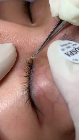 Mò #chamsocdaseo#chamsocda#chamsocdamun#chamsocdanam#tanbinh     