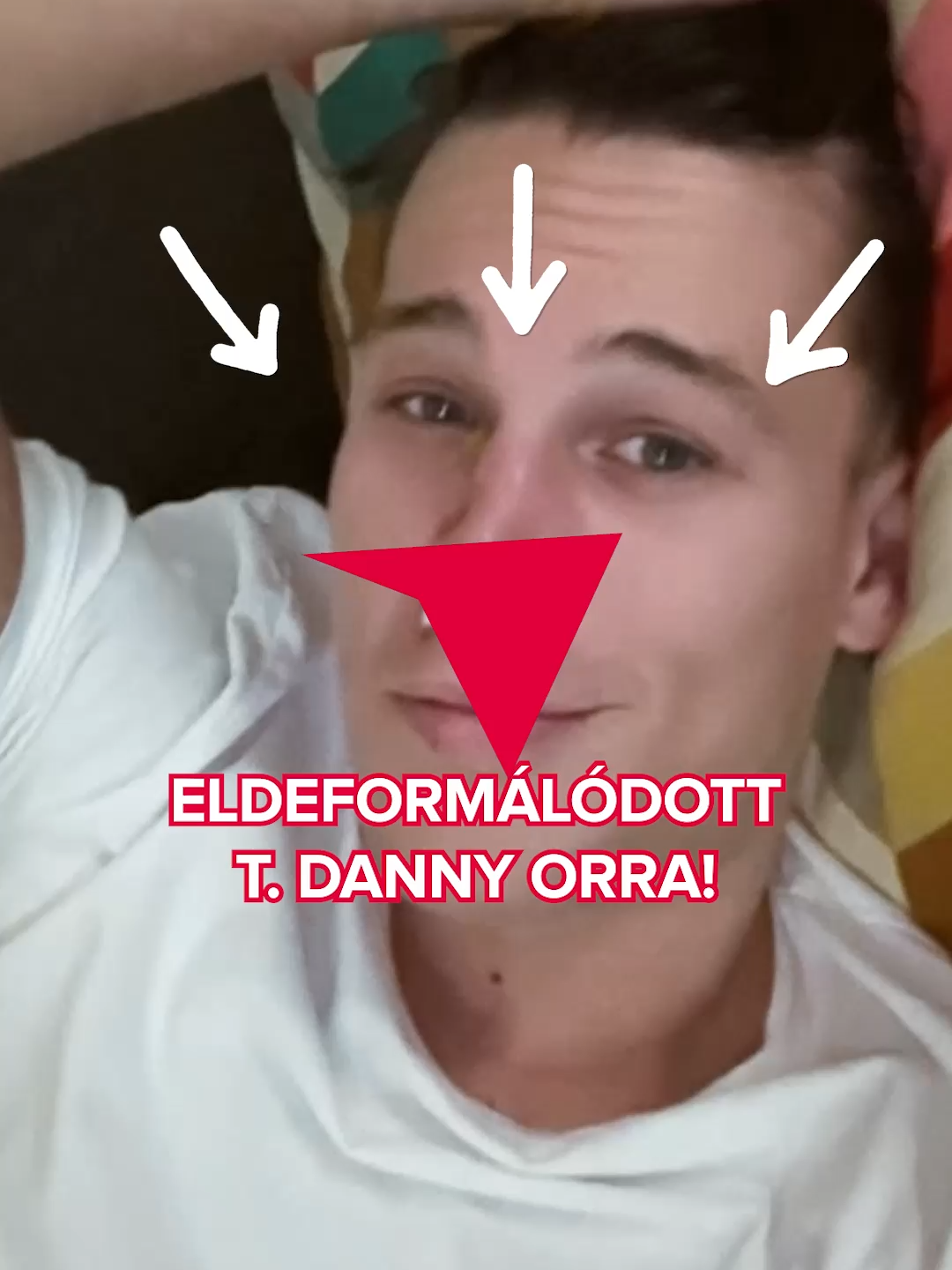 Eldeformálódott T. Danny orra Telegdy Danit népszerű rapperként emlegették az elmúlt években, ám nemrég valami megváltozott.  #tdanny #botrány #manuel #box #rapper #bors