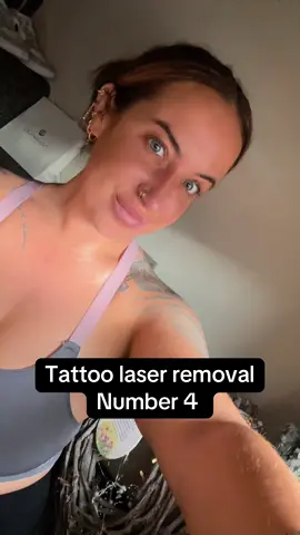 Number 4 🙌🏻 #lasertattooremoval @Rosie Dev @tattoosandjuijitsu @Bex Lawrence 