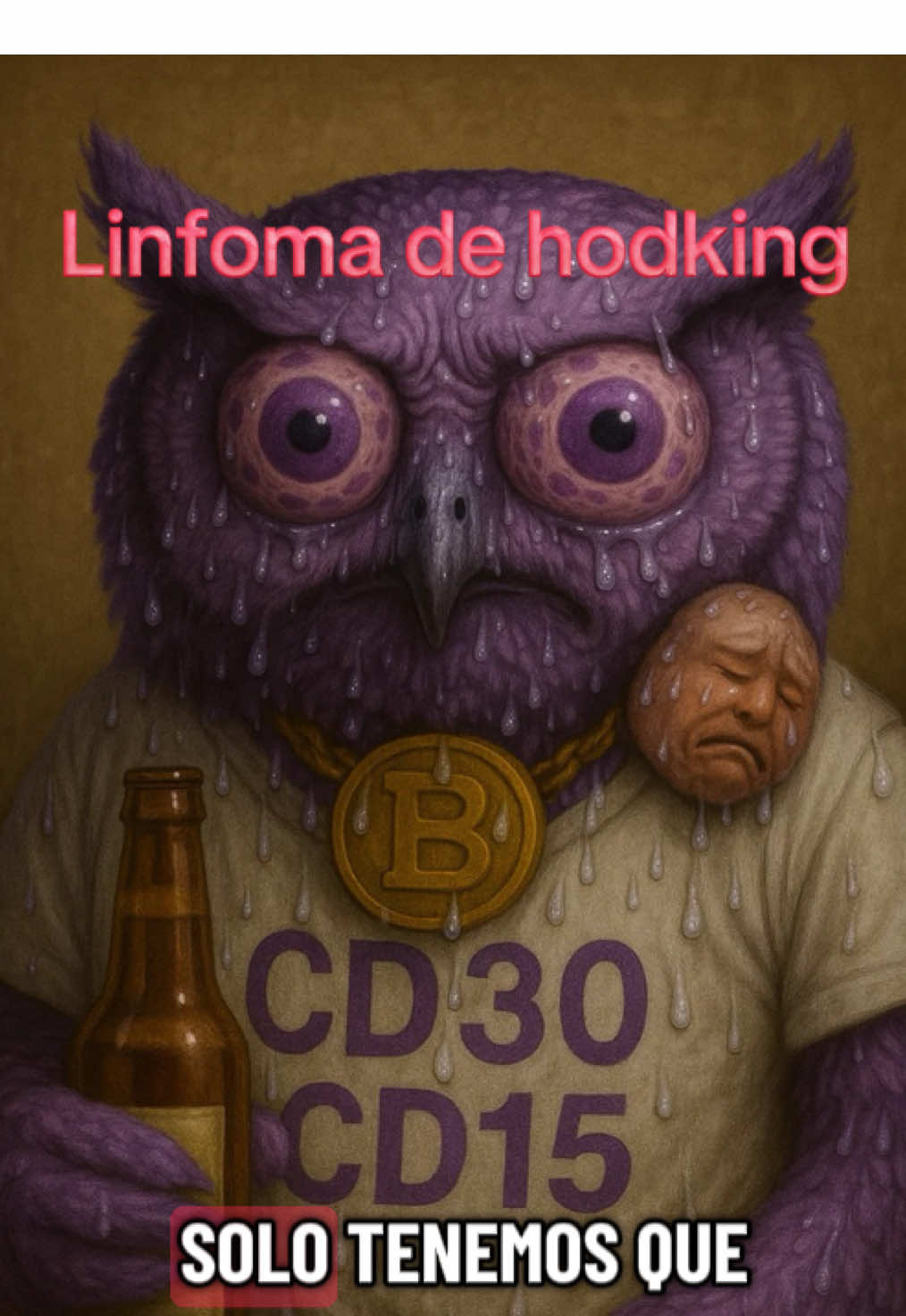 Linfoma de hodking #ENARM #fyp #gpc #doctores #linfomahodgkin 