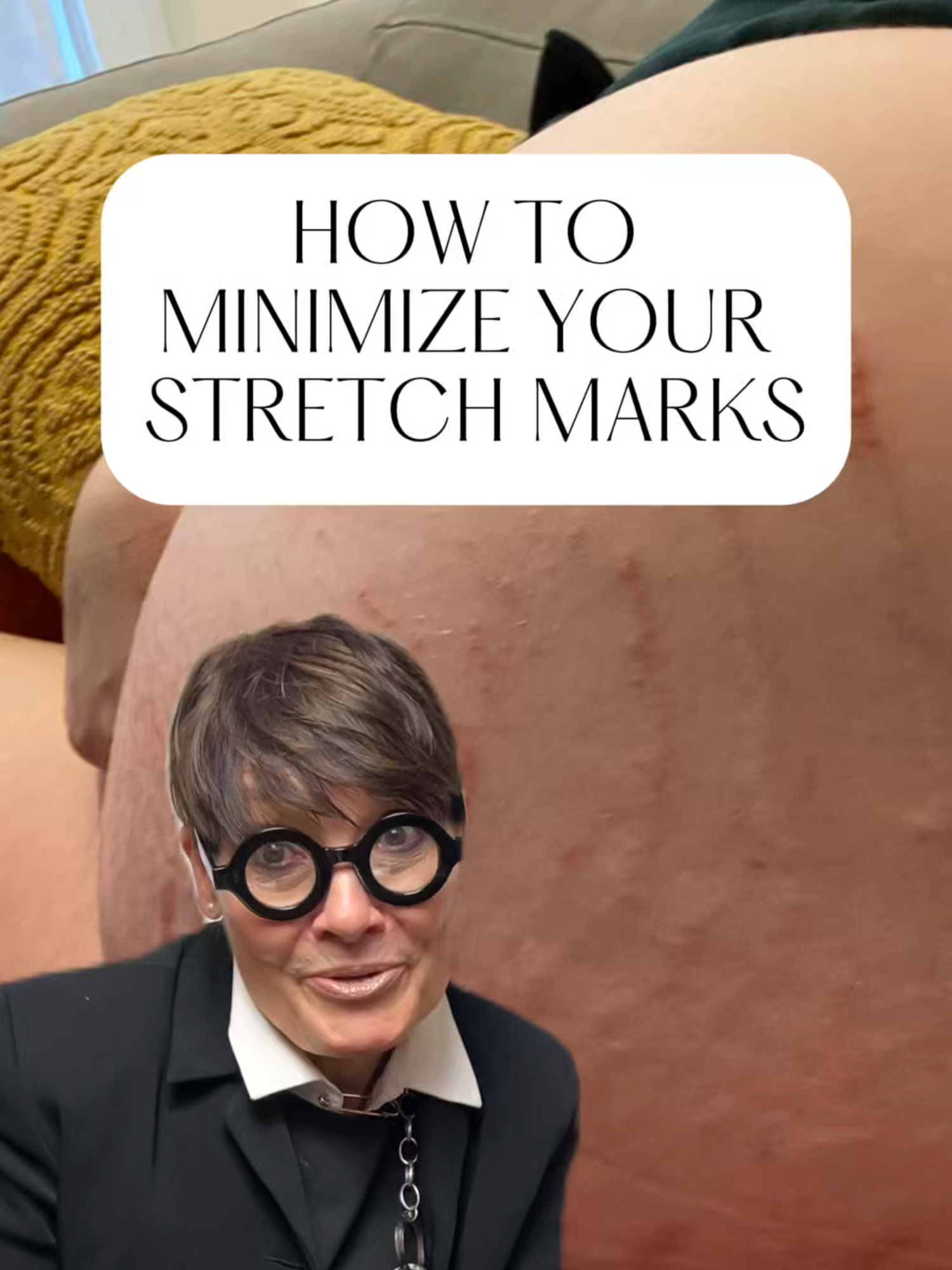 Here's how you can minimize your #stretchmarks with a #chafe product!🤰 #chafingrelief #chafing