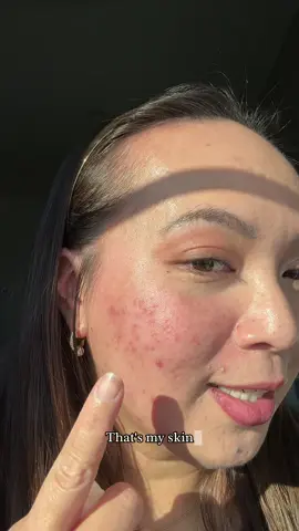 The new @makeupbymario surreal skin foundation is AMAZING!!! That's all I can say. This video is proof to that! #foundationreview #makeupbymario #BeautyTok #makeup #acneproneskin 