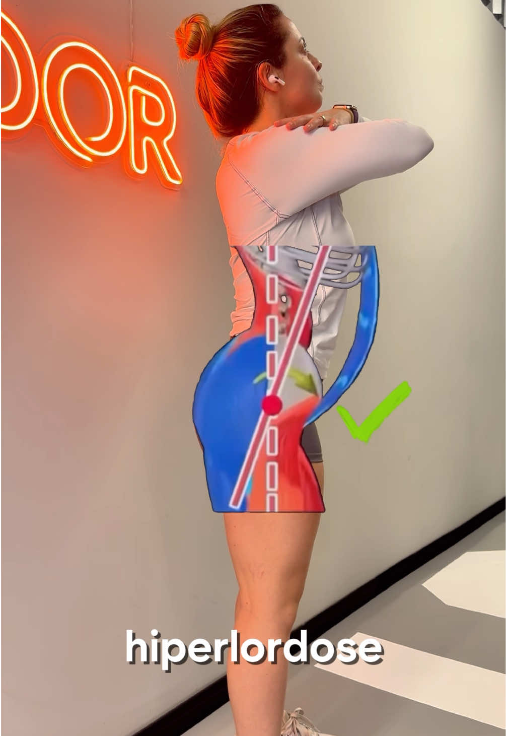 Você tem ou acredita que possa ter Hiperlordose? 😰😰 até parece algo bonito, mas seu corpo sofre com essa curvatura em exagero ❌😵 Faça este exercício aí na sua casa e vai sentir uma melhora na sua postura e sua coluna agradece!  . . #hiperlordose #coluna #dor #treino #saude 