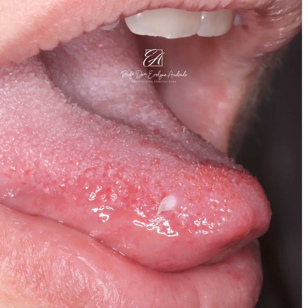 #fyp #fyyyyyyyyyyyyyyyy #fyppppppppppppppppppppppp #fy #foruyou 