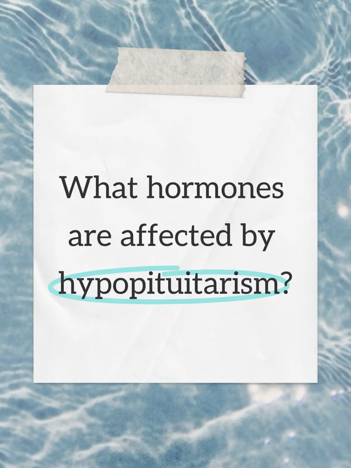 Hypopituitarism and the thyroid are closely linked because the pituitary gland is what tells the thyroid to make hormones. Here’s the connection: Normal thyroid regulation The hypothalamus releases TRH (thyrotropin-releasing hormone). TRH stimulates the pituitary to release TSH (thyroid-stimulating hormone). TSH tells the thyroid gland to produce T4 (thyroxine) and T3 (triiodothyronine). These hormones regulate metabolism, energy, and many body systems. Hypopituitarism and thyroid function In hypopituitarism, the pituitary doesn’t produce enough hormones, including TSH. Without enough TSH, the thyroid isn’t properly stimulated → secondary hypothyroidism (also called central hypothyroidism). Unlike primary hypothyroidism (where the thyroid itself is failing), in secondary hypothyroidism the thyroid gland is healthy but under-stimulated. Lab differences Primary hypothyroidism: TSH high, T4 low. Secondary (pituitary) hypothyroidism: TSH low/“inappropriately normal,” T4 low. TSH may not rise even if thyroid hormones are low, because the pituitary can’t make enough. Symptoms Similar to hypothyroidism in general (fatigue, weight gain, cold intolerance, constipation, depression, hair loss, dry skin), but often occur alongside other pituitary hormone deficiencies (low cortisol, low sex hormones, etc.). Treatment Levothyroxine (T4) replacement is given, but dosing is monitored with free T4, not TSH (since TSH is unreliable in secondary hypothyroidism). Often, adrenal function must be checked first: if there is coexisting adrenal insufficiency, hydrocortisone replacement is given before thyroid hormone, to avoid adrenal crisis.