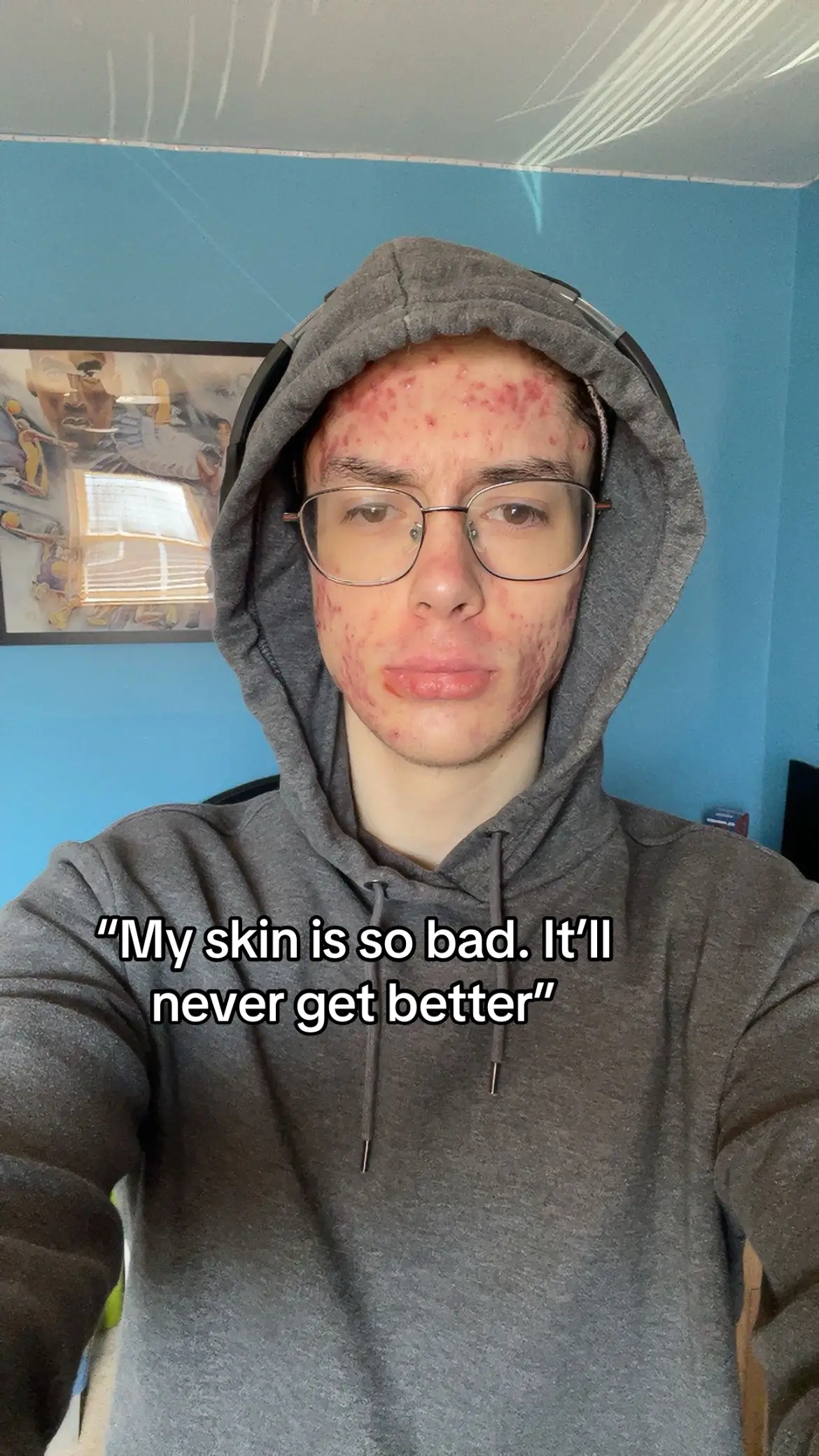 #foryoupage 
