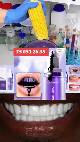 #glorysmile #dentblanches #dents #dakar #viral 