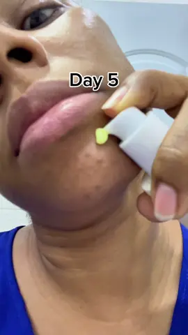 ⭐️@numbuzin Global Marketing The KSECRET Seoul-1988 serum gives a healthy glass-skin glow, improves texture, evens skin tone, reduces dark spots, smooths fine lines, boosts firmness, hydrates, and protects with antioxidants; within a few days you notice softness and radiance, and with consistent use the skin becomes more even and firm. You can buy it from trusted stores like Amazon, YesStyle, Stylevana, and StyleKorean, all with international shipping.#KSECRETGlowChallenge #KSECRET #Seoul1988 #Retinal 