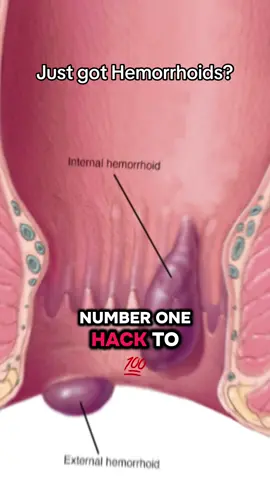 Relief without the mess. #HemHero #NoCreams #CleanCare