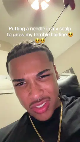 Revive ur hair follicles #bebodywise #hairgrowth #hairtok #recedinghairline #growth 