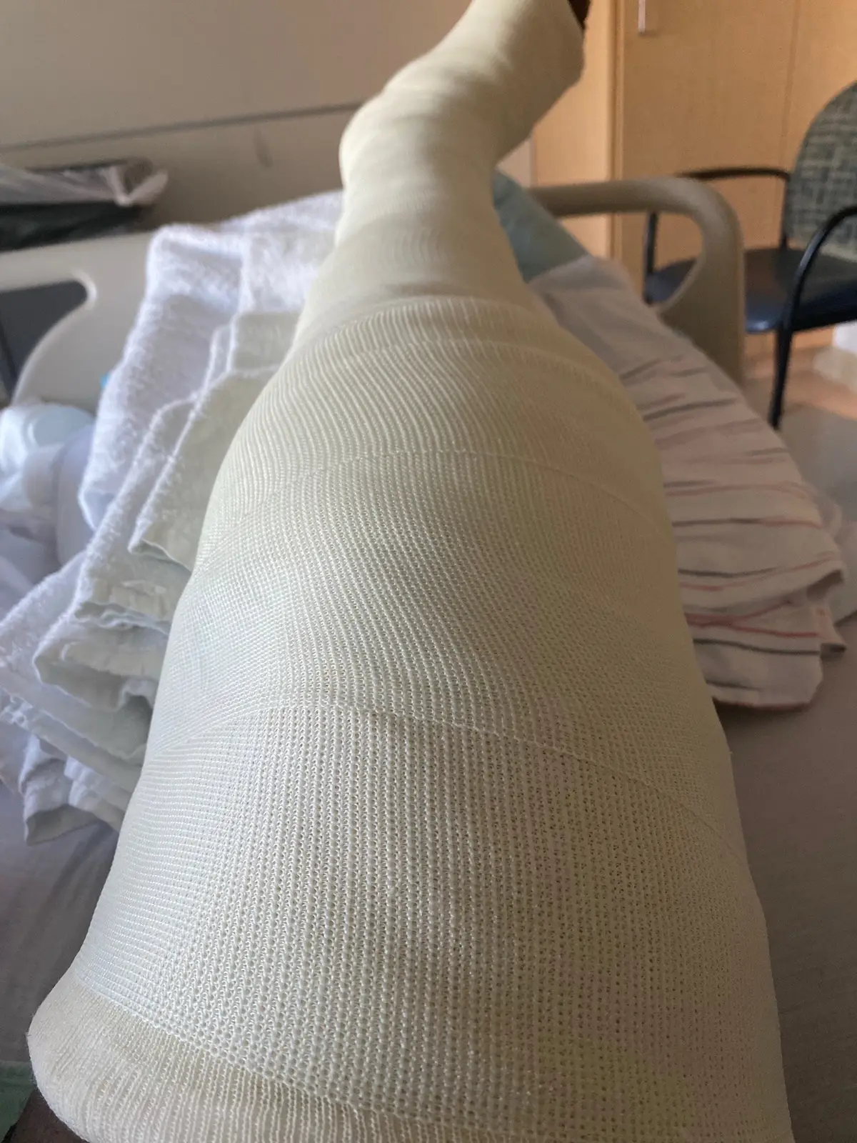 some hospital photos #thisshihurts #helpppp #fracturedknee  #fyp 