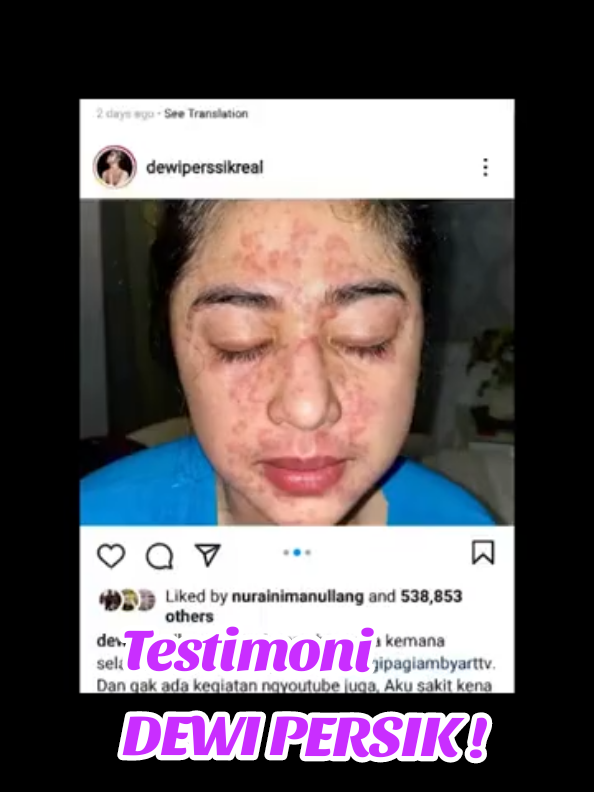 Testimoni si Dewi Persik merasakan manfaat produk AFC (Subarashi-Utshukushhii) #dewipersik #cantik #kulit #alergi #kulitsehat 
