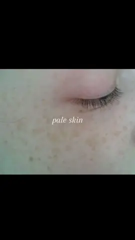 pale skin #paleskin 