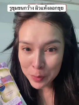 ลดเลือนจุดดำ รอยดำ เติมความชุ่มชื้น #ผิวชุ่มชื้น #ผิวใส #รีวิวบิวตี้ #ฝ้ากระจุดด่างดําจางลง #นีเวียลูมินัส630 