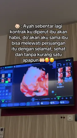 Aamiin 🤲🏻 bismillah hpl november sebentar lagi 🥹🥰#masyaallahtabarakkallah #bismillah #32weekspregnant 