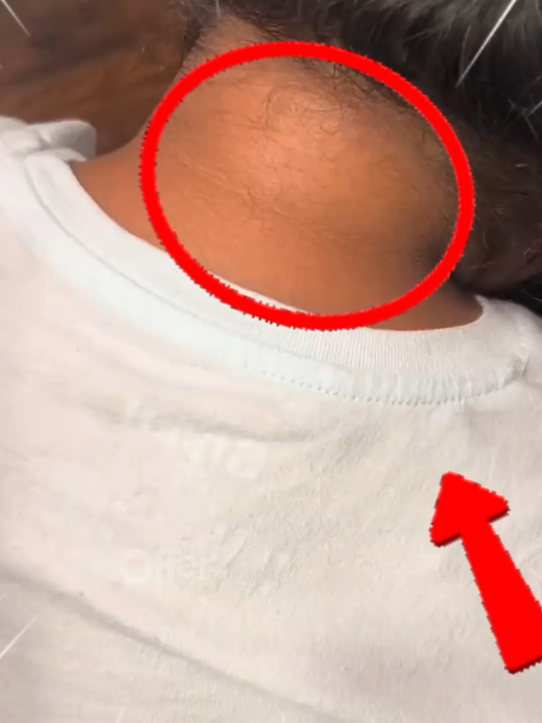 😣 ¿Zonas oscuras que te incomodan? 💧 Este gel hidrata y ayuda a unificar el tono sin irritar. 🌿 Ligero, natural y diario.