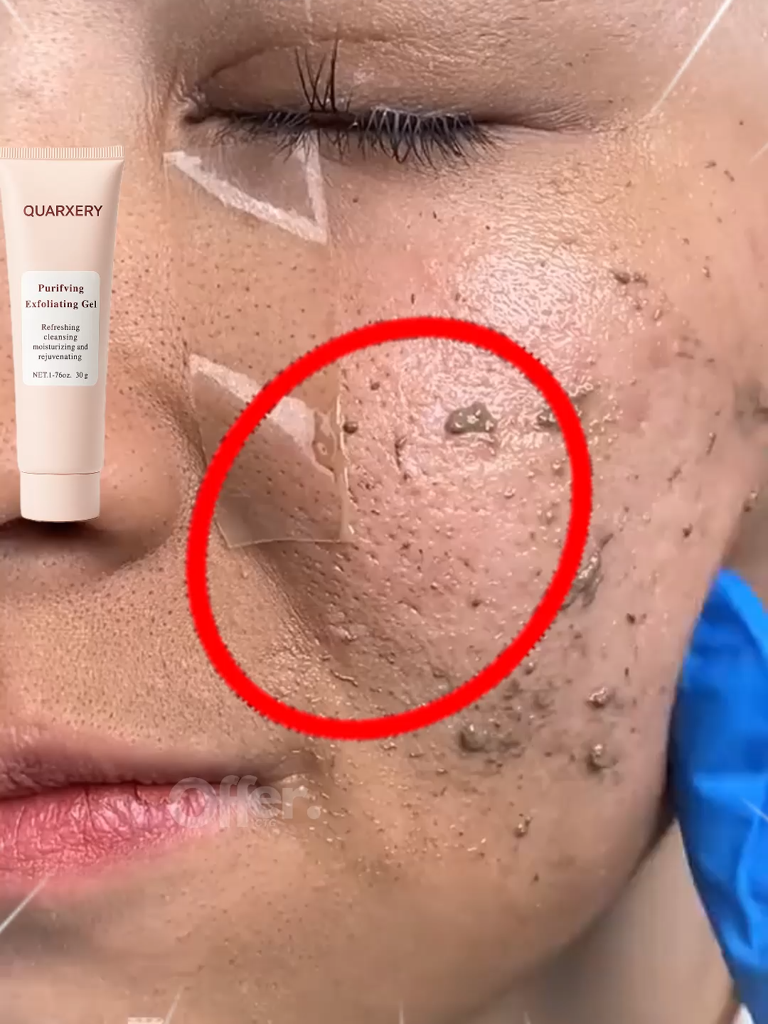 😣 ¿Zonas oscuras que te incomodan? 💧 Este gel hidrata y ayuda a unificar el tono sin irritar. 🌿 Ligero, natural y diario.