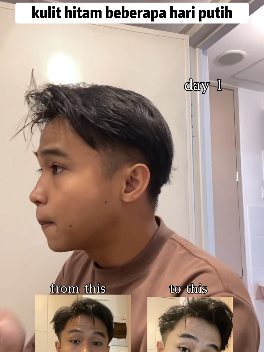 kulit hit4m beberapa hari bisa putih dengan rutin sabun cuci muka chalonese😮#wajahbersih #bersihkanporipori #SkincareFirst #chaloneseskincare #skincareisselfcare #bumilbusuiaman🥰 #CleanSkin #rekomendasi #bpomdanhalal✅ #KulitSehat #foryourbeauty #sabuncucimuka #wajahcerah #facewash #chalonesefacialwash #viral #fyppppppppppppppppppppppp #masukberanda #facialwash