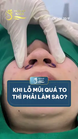 Cuộn cánh mũi tạo dáng mũi thon gọn Kiều NaLy#cuoncanhmui #thunholomui #catcanhmui #thammynaly #thunenmũi 