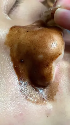 Thèm#chamsocdaseo#chamsocda#chamsocdamun#chamsocdanam#tanbinh       