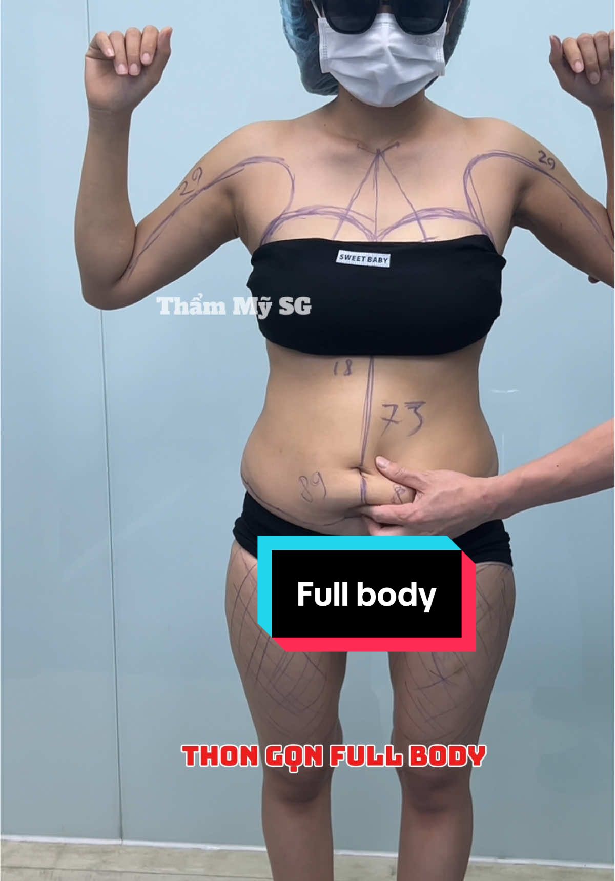 Thon gọn full body cho cô gái Indonesia #thammysg #beauty #fyp #lipo #làmđẹp 