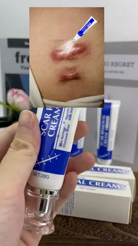 #scar #SelfCare #tiktokshopsummerturnup #fypシ #skincare 