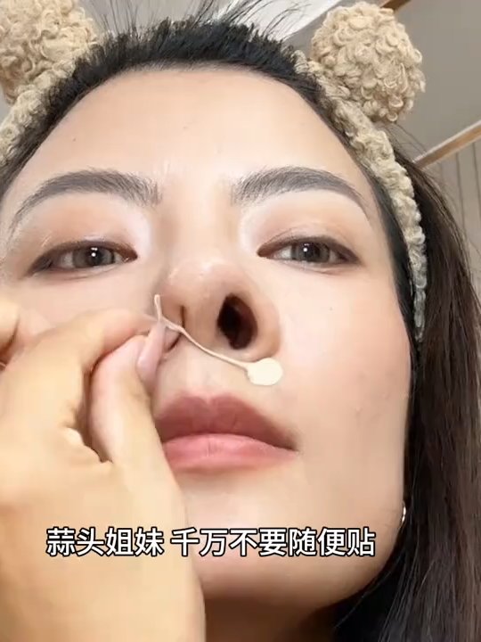 15.大鼻孔姐妹集合…我是真没想到女明星的邪修大法能这么管用#鼻翼贴 #蒜头鼻 #大鼻孔 #鼻翼肥大 #精致女生必备