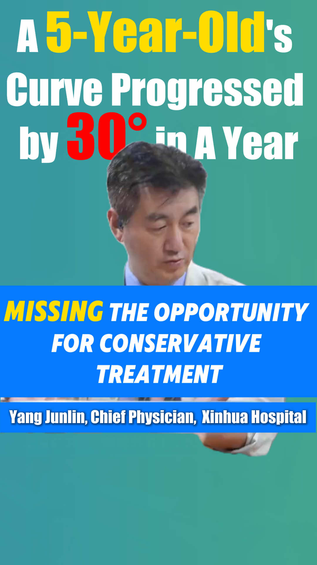 Curve Progressed by 30° in a year.#scoliosis #spinal #doctor #spine #china 