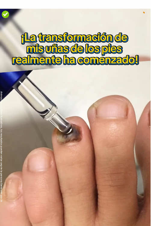 ¡Lo bueno que es, solo lo sabe quien lo prueba! ¡Mis pies son la mejor prueba!#nailcare #toenails #nails #gainknowledge #tiktokmademebuyit 