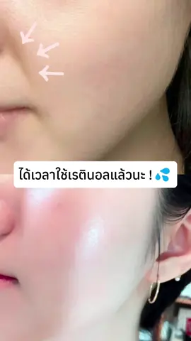 🪞ส่องกระจกแล้วตกใจ ผิวดูเรียบขึ้นจริง! ใครอยากผิวเด็กต้องลองตัวนี้เลย🪞#papafeel#papafeelth#ultra5a #ส่วนผสมเรตินอลต่อต้านวัยอันดับหนึ่ง#antiaging#กู้ผิว#เทรนด์วันนี้tiktok#viral