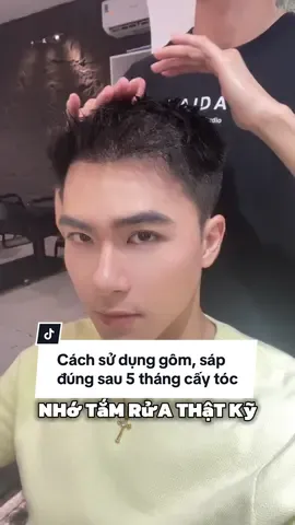 Cấy tóc sau 5 tháng lưu ý sử dụng gôm, sáp #fyp #review #lamdep #caytoc #caytoctuthan 