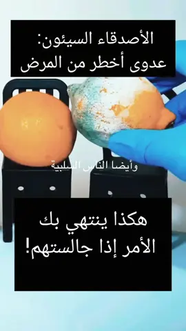 #زيزوanzo 