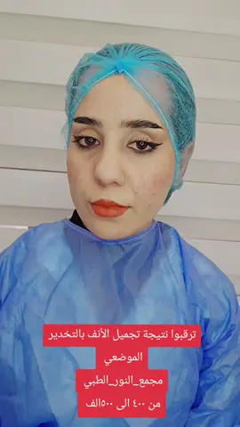#تجميل_الأنف #دكتورة_نور_امين 