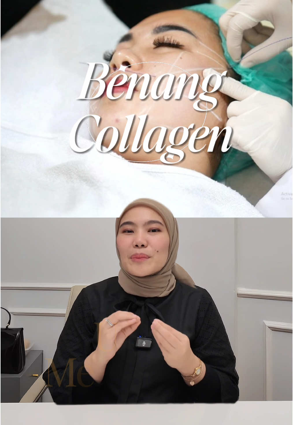 Ada yang sama ? Yuk cegah flekmu.. #kontenedukasi #doktertiktok #tanyadokter #flekhitam #kantungmata #doktertiktok #flekhitam 