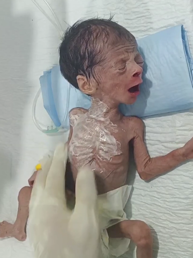 #newborn #adorable #baby #cutebaby #babyfirstbreath 