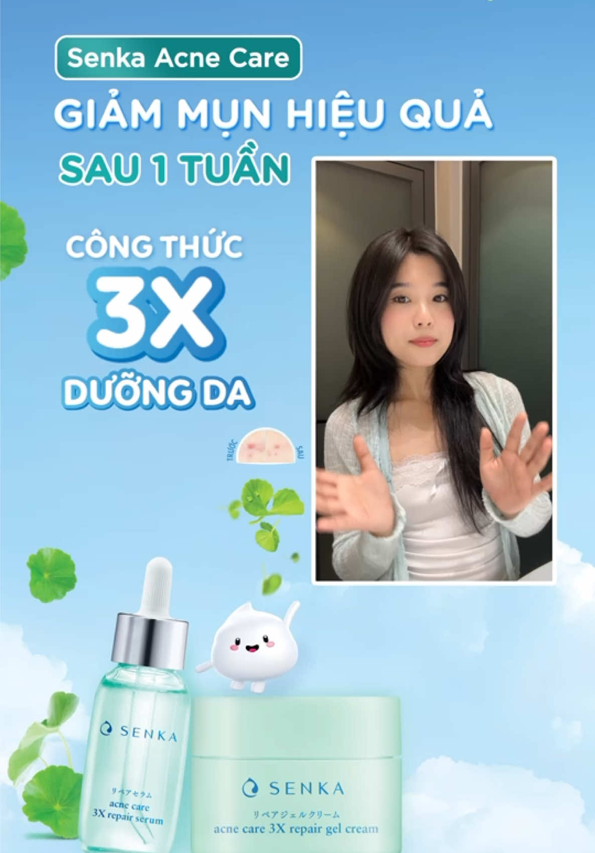 Chuỗi mụn kéo dài vì những ngày căng thẳng với deadline🥲 Đã đến lúc dứt chuỗi mụn mở chuỗi da xinh cùng bộ đôi Senka Acne Care giảm mụn hiệu quả sau 1 tuần🩵#SenkaAcneCare3XRepair #GiamMunHieuQuaSau1Tuan #senkavietnam 