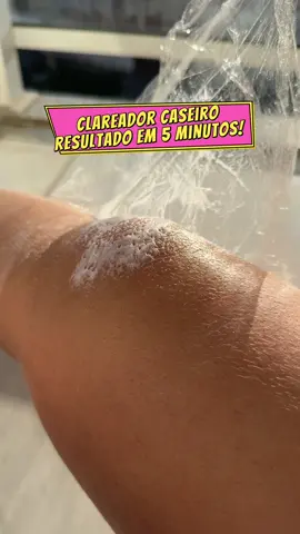 ✨ Diga adeus aos cotovelos e joelhos escuros! ✨ Com essa receitinha caseira você conquista um clareamento gradativo e seguro. Use 1x na semana, e não se esqueça: depois é essencial hidratar bem a região 💧. ⚠️ Dica importante: sempre faça o teste de toque antes de aplicar para garantir que sua pele aceite bem a mistura.